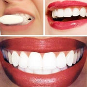 Dental Clinic now offers Braces! Straight smile in 6 months! 