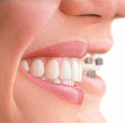 Dentists in dublin - Portobello Dental Clinic